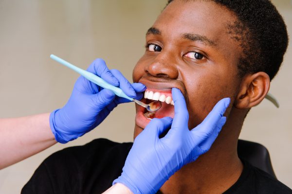 What To Do When Your Tooth Revolt-- DENTAL CALCULUS