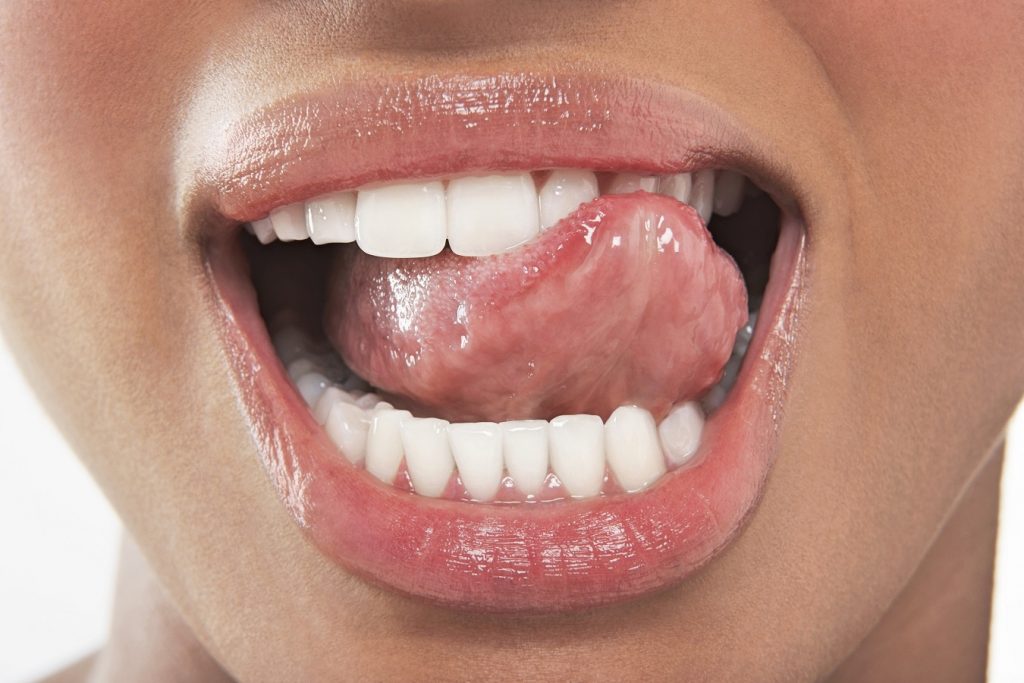 5 Natural Ways To Treat Burning Tongue Syndrome