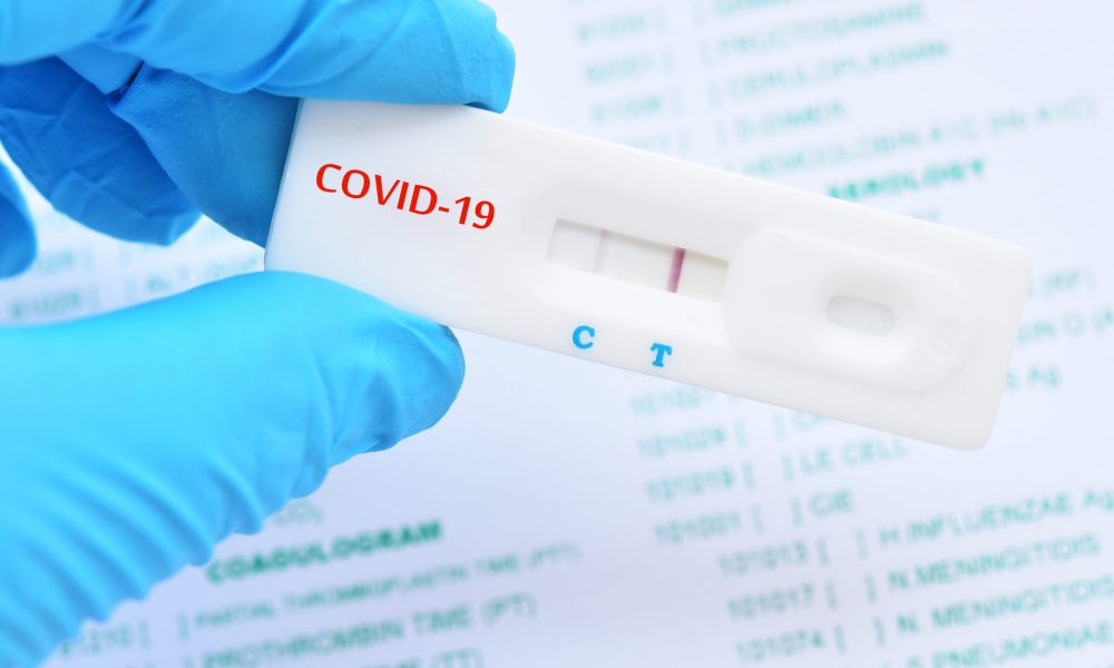 COVID-19: Rapid Test Vs PCR Test: What We Should Know